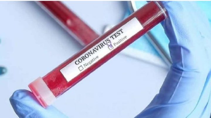 CHASCOMUS: Se registró un nuevo caso de Coronavirus.