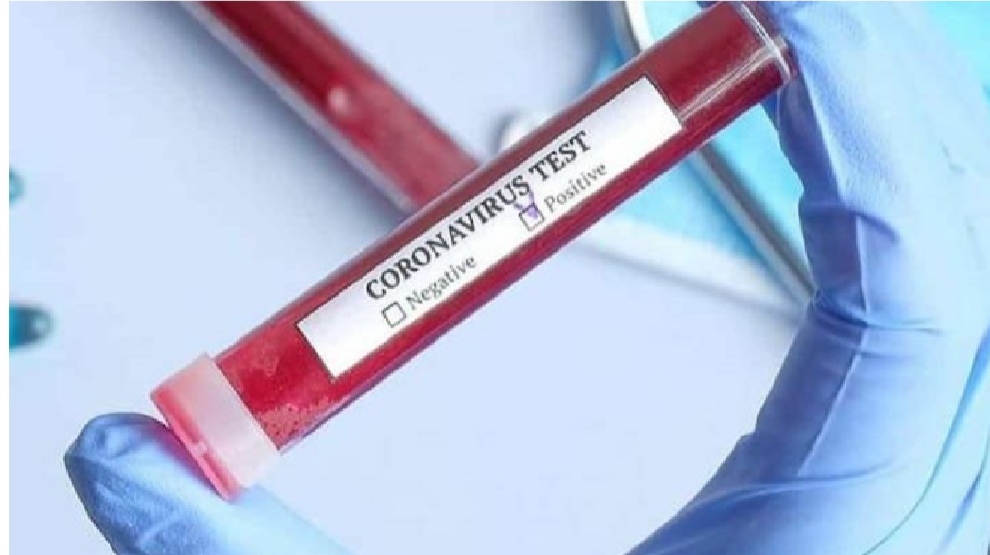 CHASCOMUS: Se confirmó el séptimo caso positivo de coronavirus CHASCOMUS: Se confirmó el séptimo caso positivo de coronavirus