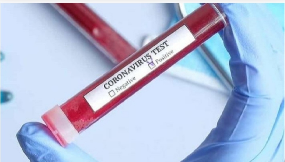 LOBOS: Nuevo caso positivo de coronavirus LOBOS: Nuevo caso positivo de coronavirus
