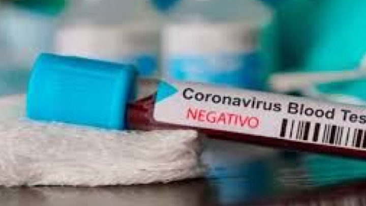 PILA: Dieron negativo los resultados de coronavirus al personal de la fuerza policial