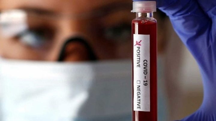 Ranchos tiene su primer caso positivo de coronavirus