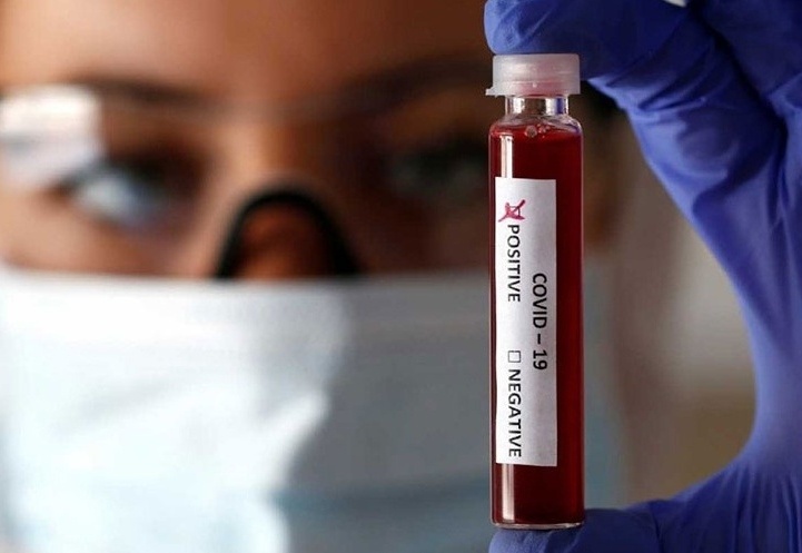 Ranchos tiene su primer caso positivo de coronavirus
