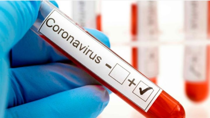 PILA: Se registró el primer caso positivo de coronavirus
