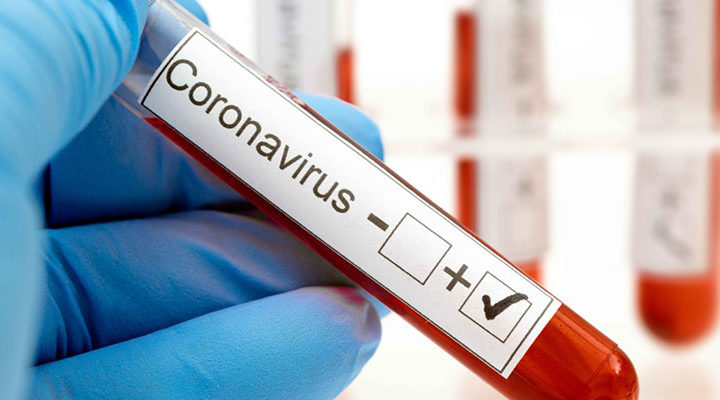 GRAL BELGRANO: Se confirmó el primer caso positivo de coronavirus